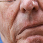 Gejala dan jenis stroke hingga cara menanganinya