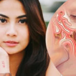 Sinusitis: Jenis, Gelaja, Penanganan dan Pengobatan Pengertian Sinusitis