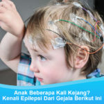 Gejala Epilepsi