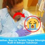Bayi ini terlahir tanpa kulit