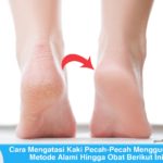 Cara Mengatasi Kaki Pecah-Pecah Menggunakan Cara Alami Hingga Obat Berikut Ini Cara mengatasi kaki pecah-pecah