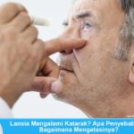 Katarak: Penyebab, Gejala, Mencegah dan Mengobati Penyebab dan Cara Mengatasi Katarak Pada Lansia