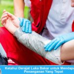 Mengatasi luka bakar berdasarkan derajatnya