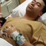 Vidi Aldiano idap kanker ginjal, berikut gejalanya