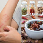 5 Obat Eksim Alami Tradisional dan Cara Menggunakannya 5 Obat Eksim Alami Tradisional