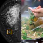 Bahaya kemasan plastik untuk membungkus makanan dapat sebabkan kanker