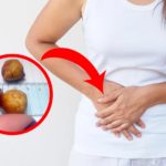 Batu Empedu: Gejala, Penyebab, Pengobatan dan Pencegahan Batu Empedu: Gejala, Penyebab, Pengobatan dan Pencegahan