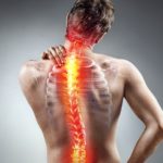 Skoliosis - Penyebab, Bahaya, Gejala dan Pengobatan