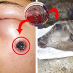 Antraks: Penularan, Gejala, Pengobatan dan Pencegahan