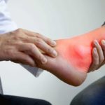 Asam Urat: Penyebab, Gejala, Pengobatan, dan Pencegahan asam urat