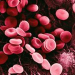 Kelainan Darah: Penyebab, Gejala, Pengobatan dan Pencegahan kelainan darah