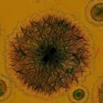 Hepatitis E: Penularan, Gejala, Pengobatan dan Pencegahan Hepatitis E