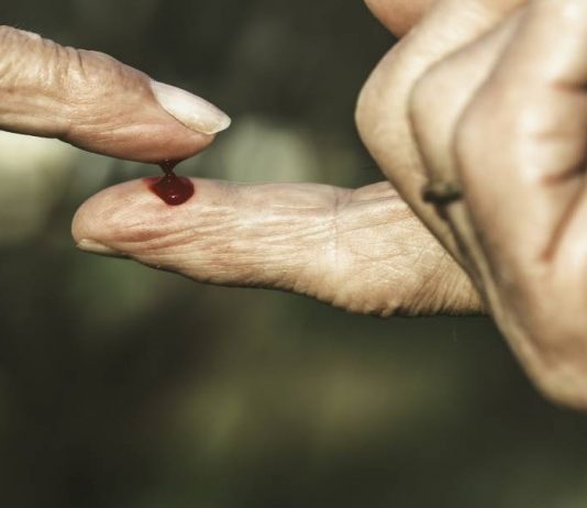 pendarahan pada lansia