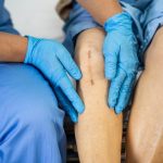 Berikut Tarif Dan Cara Pemesanan Jasa Home Care Untuk Perawatan Luka Di Rumah