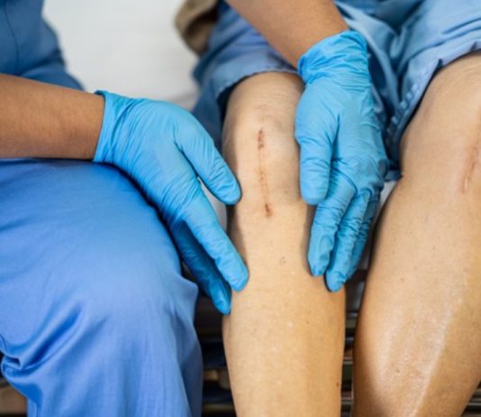 Berikut Tarif Dan Cara Pemesanan Jasa Home Care Untuk Perawatan Luka Di Rumah