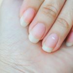 Tanda Kondisi Kesehatan Dilihat Dari Kuku