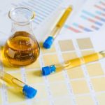 7 Arti Warna Urine Bagi Kesehatanmu