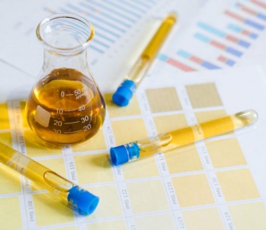 7 Arti Warna Urine Bagi Kesehatanmu