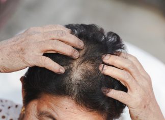 Cara Atasi Rambut Menipis yang Terjadi pada Lansia, Simak yuk!