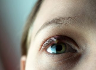 Sering Mengalami Bintitan di Kelopak Mata? Mungkin Ini Penyebabnya