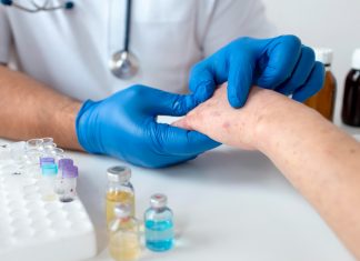 Alergi Biduran: Pahami Jenis, Penyebab, dan Cara Mengatasinya