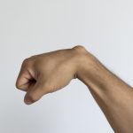 Waspada Kista Ganglion: Benjolan yang Muncul di Pergelangan Tangan