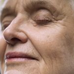 Muncul Milia pada Wajah Lansia? Ini Penyebab dan Cara Mengatasinya
