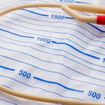 Jasa Pasang Kateter di Rumah Bikin Lebih Nyaman dan Aman Jasa Pasang Kateter di Rumah